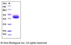 Sino Biological Recombinant Human SFRP1 Protein (His Tag), HPLC-verified,