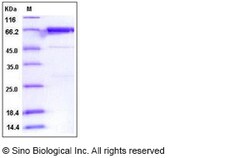 Sino Biological Human PTK6 / Brk Protein (GST Tag) 50ug, Quantity: Each