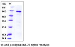 Sino Biological Recombinant Human MAPKAPK3 Protein (GST Tag), Quantity: