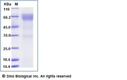 Sino Biological Recombinant Human Angiopoietin-2/ANGPT2 Protein (His Tag),