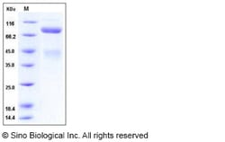 Sino Biological Recombinant Human c-MET/HGFR Protein (ECD, His Tag), HPLC-verified,