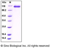 Sino Biological Recombinant Human Neuropilin-2/NRP2 Protein (His Tag),