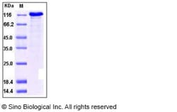 Sino Biological Recombinant Human TIE-2 Protein (ECD, His & hFc Tag), HPLC-verified,