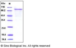 Sino Biological Human CSF2RA / GM-CSFR / CD116 Protein (Fc Tag) 100ug,