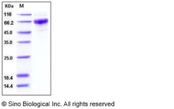 Sino Biological Recombinant Human GM-CSF Receptor alpha Protein (His Tag),