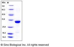 Sino Biological Beta-amyloid 40 / Beta-APP40 Protein, Human, Recombinant
