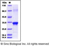 Sino Biological Beta-amyloid 39 / Beta-APP39 Protein, Human, Recombinant