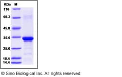 Sino Biological Human Beta-amyloid 38 / Beta-APP38 Protein (aa 672-709,