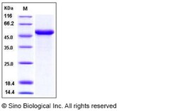 Sino Biological Human Interferon beta / IFN-beta / IFNB Protein (Fc Tag)
