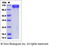 Sino Biological Recombinant Human Meprin beta Protein (ECD, His Tag), Quantity: