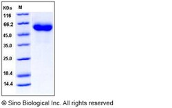 Sino Biological Recombinant Human Factor H Protein (His Tag), HPLC-verified,
