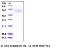 Sino Biological Human sFRP4 Protein (His Tag) 50ug, Quantity: Each of 1
