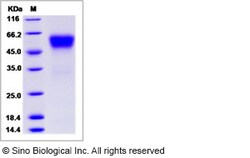 Sino Biological Recombinant Human SFRP4 Protein (His Tag), HPLC-verified,