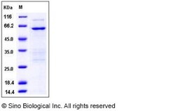 Sino Biological Recombinant Human TRIB2 Protein (His & GST Tag), Quantity: