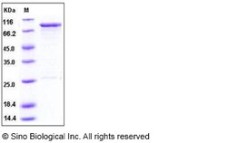 Sino Biological Human OXSR1 / OSR1 Protein (GST Tag) 50ug, Quantity: Each