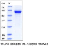 Sino Biological Human CAMK1D / CKLiK Protein (GST Tag) 50ug, Quantity: