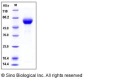 Sino Biological Recombinant Human DDR1 Protein (His Tag), HPLC-verified,