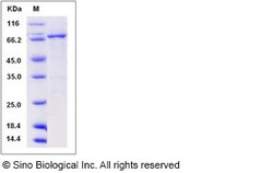Sino Biological Recombinant Human DDR1 Protein (aa 444-913, His & GST Tag),