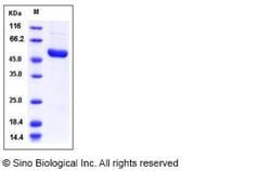 Sino Biological Human IRAK4 / IRAK-4 Protein (His Tag) 50ug, Quantity: