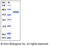 Sino Biological Recombinant Human CDK1/CDC2 Protein (GST Tag), Quantity:
