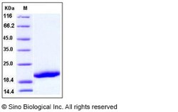 Sino Biological Recombinant Human CD42c Protein (His Tag), Quantity: Each