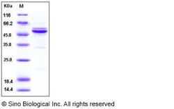 Sino Biological Recombinant Human JNK2 Protein (His Tag), Quantity: Each