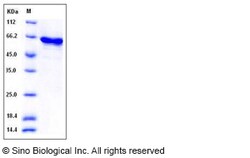 Sino Biological Recombinant Human P38 Delta/MAPK13 Protein (GST Tag), Activated