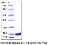 Sino Biological Recombinant Human VAPB Protein (His Tag), Quantity: Each