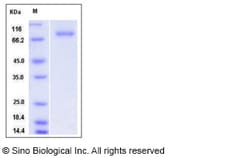Sino Biological Human SRC Kinase / Proto-oncogene c-Src Protein (His &