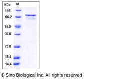 Sino Biological Recombinant Human ZIP Kinase/DAPK3 Protein (GST Tag), Quantity: