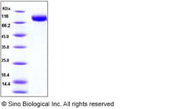 Sino Biological Recombinant Human MICB Protein (His & hFc Tag), Quantity: