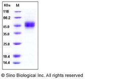 Sino Biological Recombinant Human MICB Protein (His Tag), HPLC-verified,