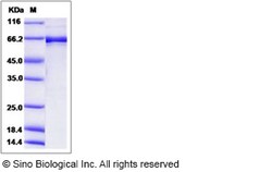 Sino Biological Human EphB2 / Hek5 Protein (aa 570-987, His & GST Tag)