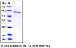 Sino Biological Recombinant Human AKT1 Protein (His Tag), HPLC-verified,