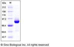 Sino Biological Human AKT3 Protein (GST Tag) 50ug, Quantity: Each of 1