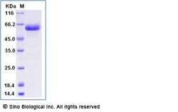 Sino Biological Recombinant Human CD40/TNFRSF5 Protein (ECD, hFc Tag),