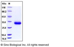 Sino Biological Human CD40 / TNFRSF5 Protein (His Tag) 100ug, Quantity: