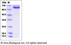 Sino Biological Human TGFBR3 / Betaglycan Protein (His Tag) 100ug, Quantity: