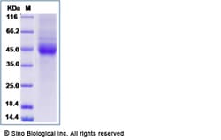 Sino Biological Recombinant Human IL-22BP Protein (His Tag), Quantity: