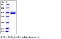 Sino Biological Recombinant Human CD5L Protein (His Tag), HPLC-verified,