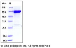 Sino Biological Recombinant Human JNK1 Protein (GST Tag), Quantity: Each