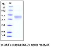 Sino Biological Recombinant Human CD48 Protein (His Tag), Quantity: Each