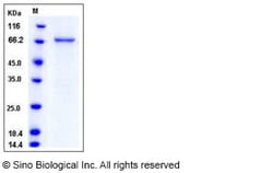 Sino Biological Recombinant Human MAP3K8 Protein (GST Tag), Quantity: Each