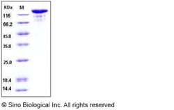 Sino Biological Recombinant Human VEGFR3/FLT4 Protein (ECD, hFc Tag), HPLC-verified,