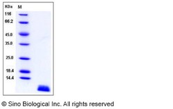 Sino Biological Human Uteroglobin / SCGB1A1 Protein (His Tag) 100ug, Quantity: