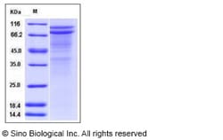 Sino Biological Human DSC2 / Desmocollin-2 Protein (His Tag) 100ug, Quantity:
