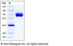 Sino Biological Recombinant Human CD21 Protein (His Tag), HPLC-verified,