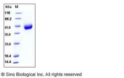 Sino Biological Recombinant Human CD38 Protein (ECD, His Tag), HPLC-verified,