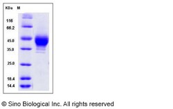 Sino Biological Recombinant Human CD38 Protein (His & FLAG Tag), HPLC-verified,