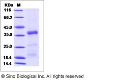 Sino Biological Recombinant Human CER1 Protein (His Tag), HPLC-verified,